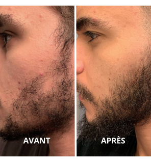 Huile d'Argan Bio | Peau, Cheveux et Soin du Corps