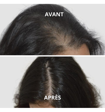 Huile de Nigelle Bio (Cumin Noir)