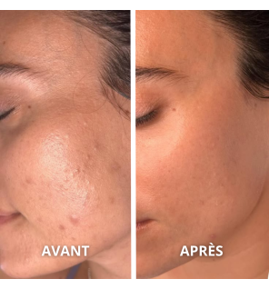 Huile de Chanvre Bio | Skin, Hair, and Massage