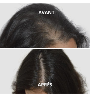 Huile de Nigelle Bio Pure | Huile de Cumin Noir - Soins Cheveux et Peau