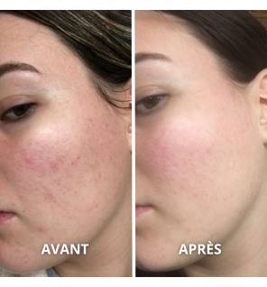 Huile d'Amande Douce Bio | Peau, Cheveux et Massage