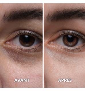 Huile de Pépins de Figue de Barbarie BIO | Anti-âge & Hydratation